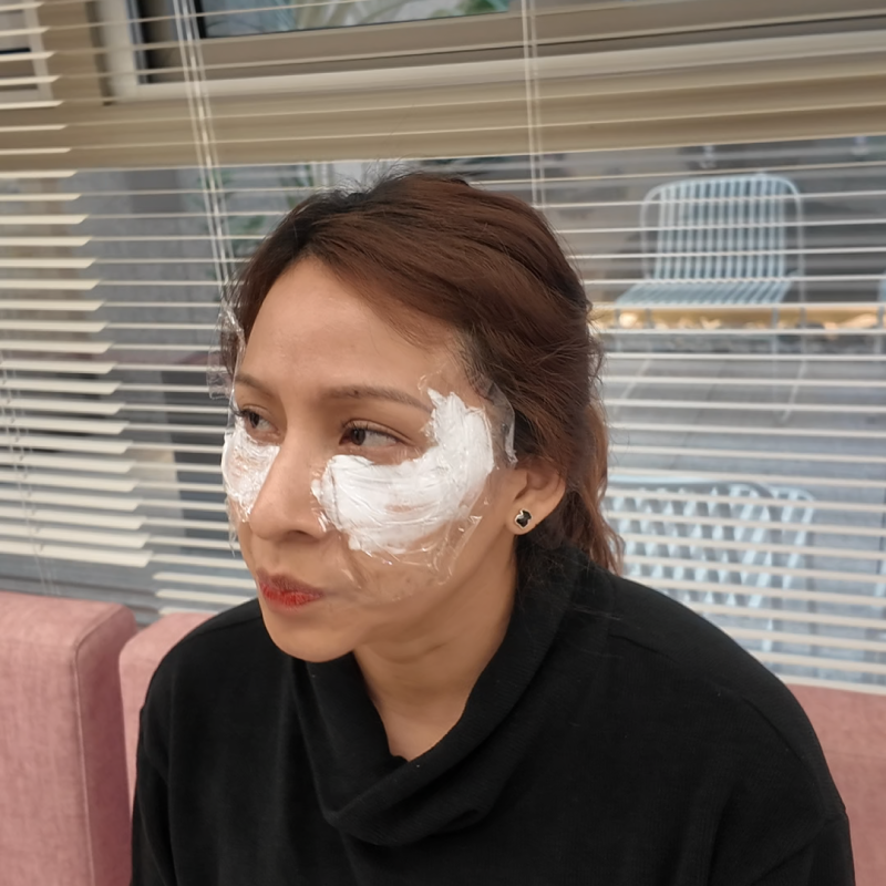 홍대 리쥬란 엠보싱이 없으면 효과도 없는 걸까요? 사진 9
