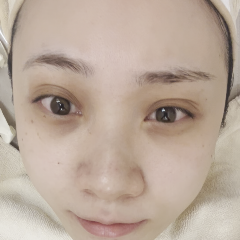 홍대 포텐자 N팁과 펌핑팁, 무엇이 다르고 어떻게 선택할까요? 사진 5
