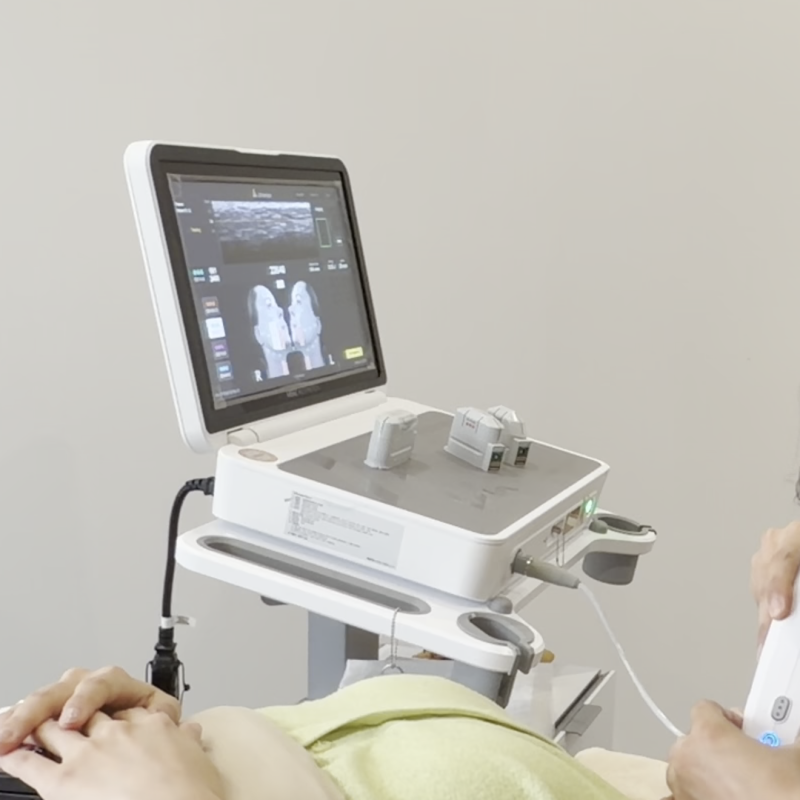 Ultherapy di Hongdae: Bisakah Dilakukan Jika Lemak Pipi Sedikit? 사진 6