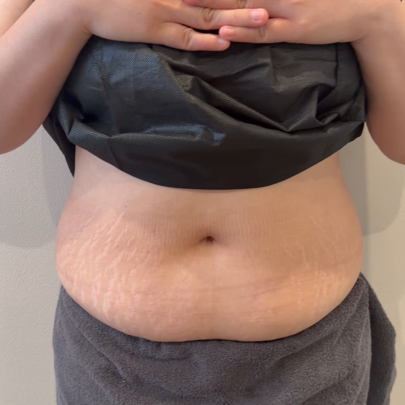 홍대 바디 온다, 체중 감량과 라인 관리는 어떻게 다를까요? 사진 4