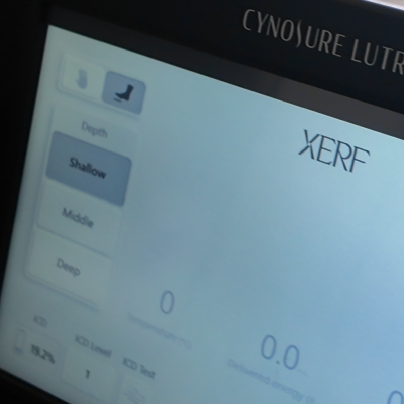 마포 세르프 눈가, 얇은 눈가 피부에 고주파를 쓸 때 무엇을 먼저 볼까요? 사진 7